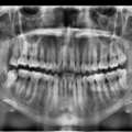 Get That Ideal Smile Makeover From The Best Tijuana Dentist