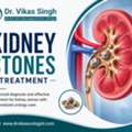 Kidney Stone Consultation Before Choosing Any Treatment