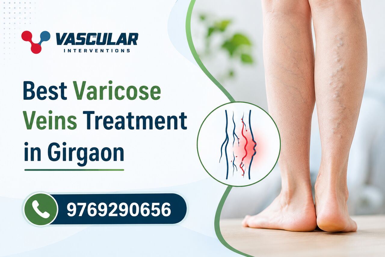 Mumbai, Health, Professional Care For Better Vein Health