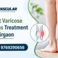 Professional Care For Better Vein Health