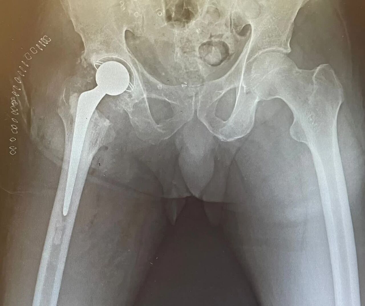 Faridabad, Health, Trusted Orthopedic Doctor In Faridabad