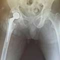 Trusted Orthopedic Doctor In Faridabad