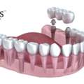 Best Dentist In CG Road