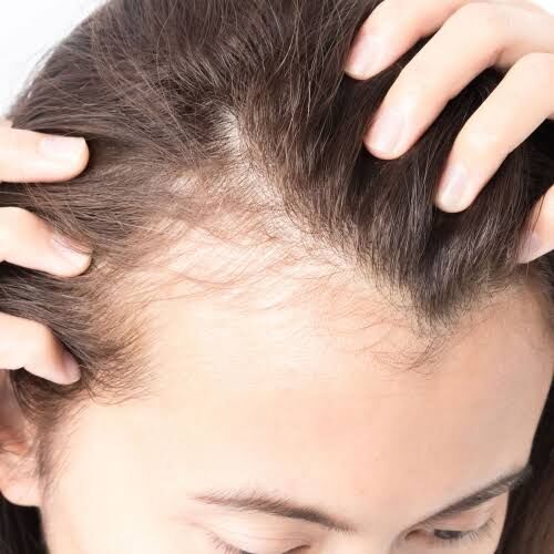 New York, Beautician, Scalp Micropigmentation: A Natural Solution For Thinning Hair And Baldness