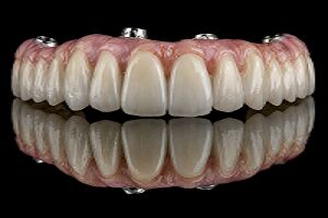 Dallas, Dental, Professional Dental Cleaning In Fort Worth | Healthy Smiles Start Here