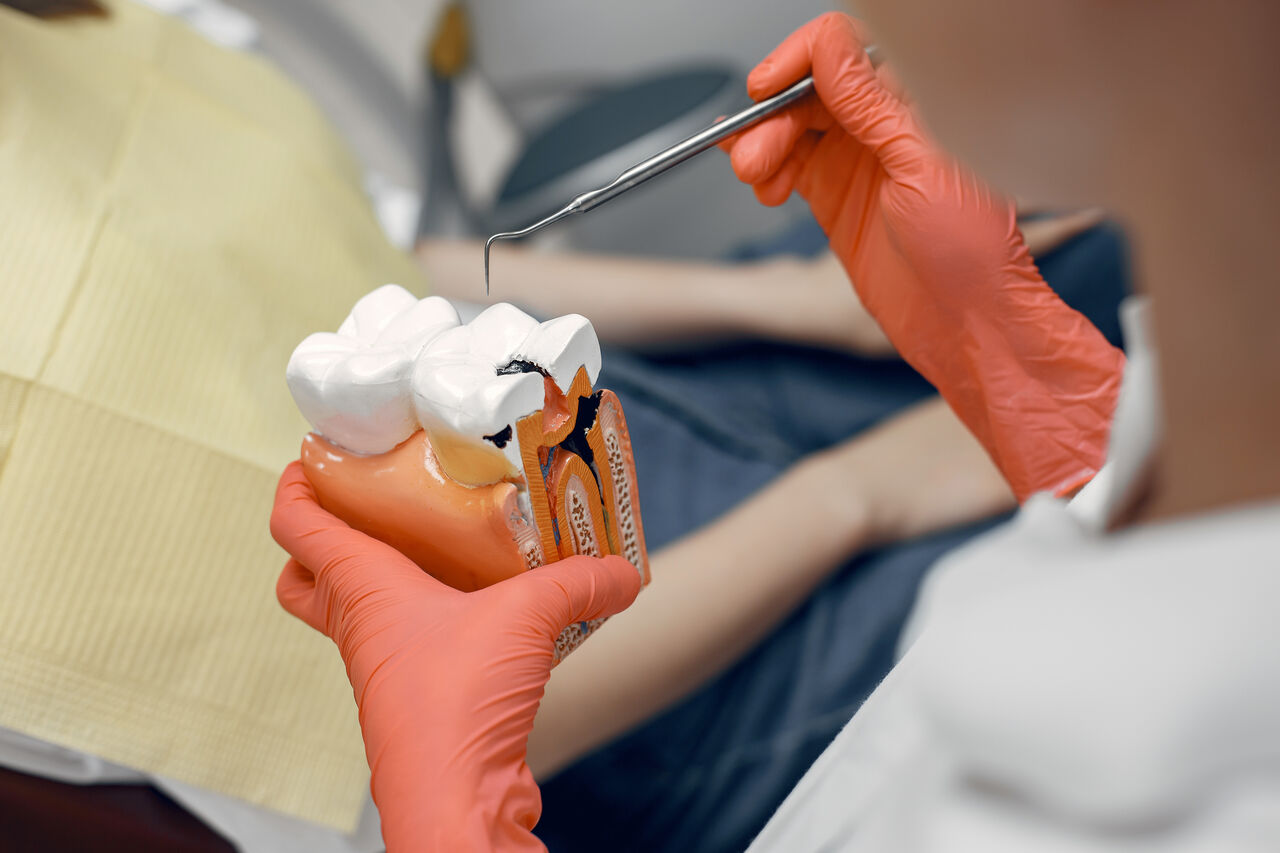 Sydney, Health, Root Canal Treatment In Mt Gravatt - Quality Dental Care Mt Gravatt