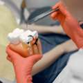 Root Canal Treatment In Mt Gravatt - Quality Dental Care Mt Gravatt