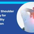 Private Shoulder Surgery For Instability In London- Align Orthopaedics