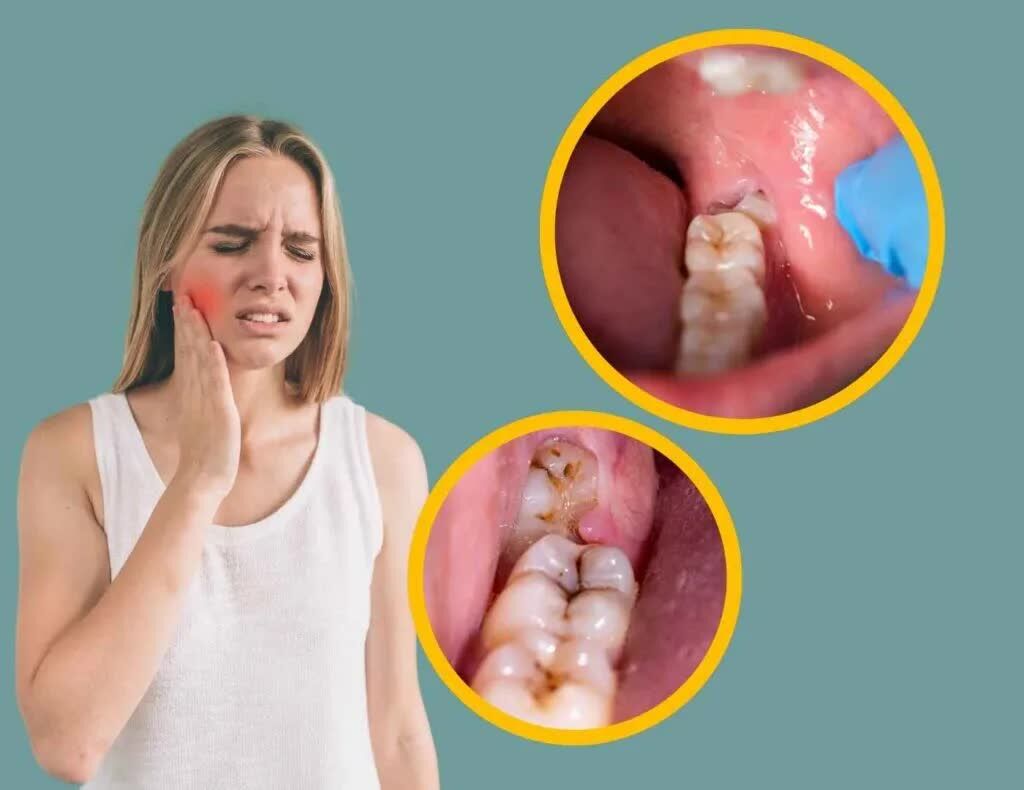 Brampton, Dental, Dental Clinic Brampton | Trusted Dentist In Brampton