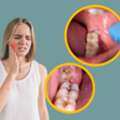 Dental Clinic Brampton | Trusted Dentist In Brampton