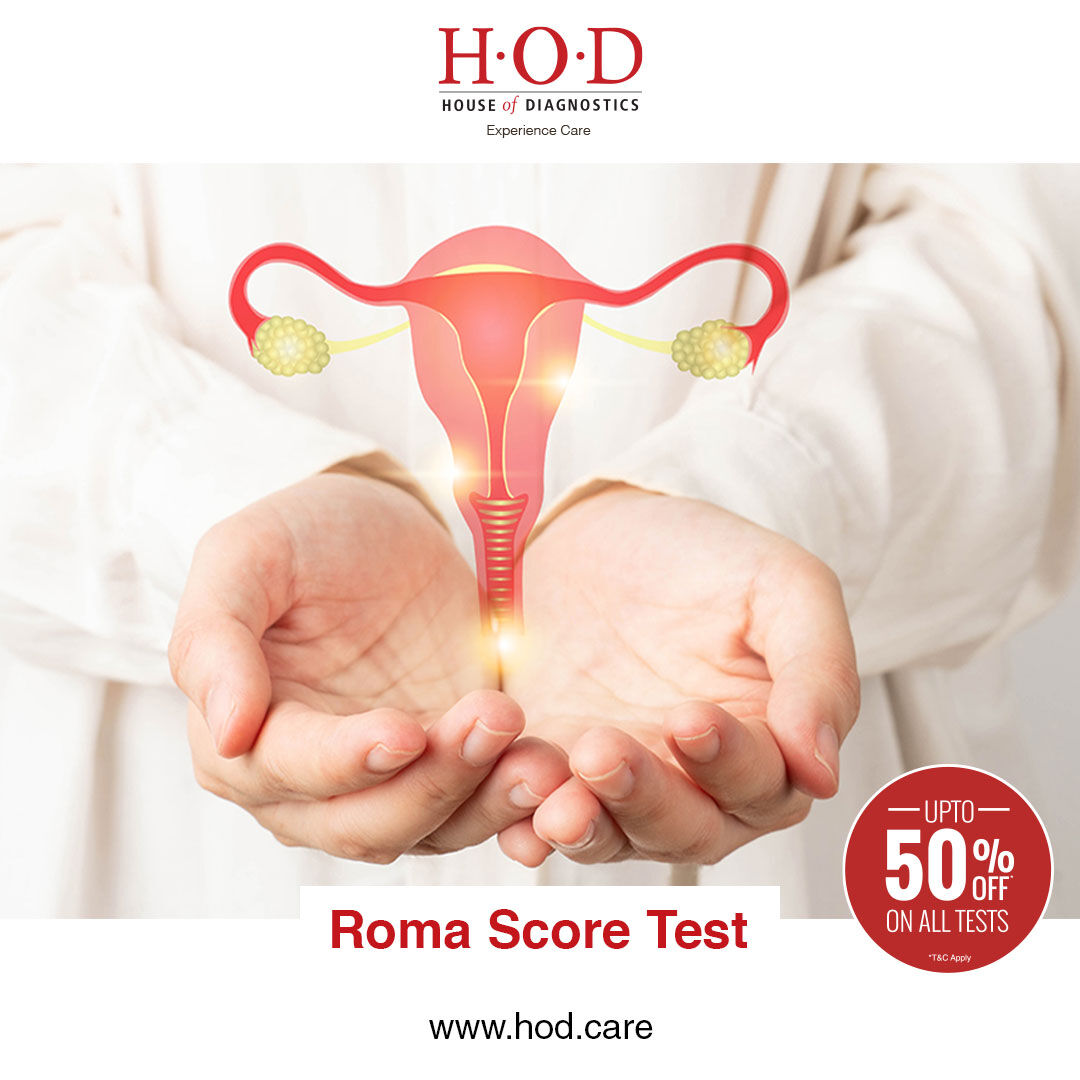 New Delhi, Health & Beauty Items, INR 2199,  ROMA Score Test Price And Diagnostic Information