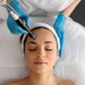 Harmony Laser Treatment Chino Hills | Advanced Skin Care
