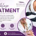 Is SmoothLase Treatment Worth It?