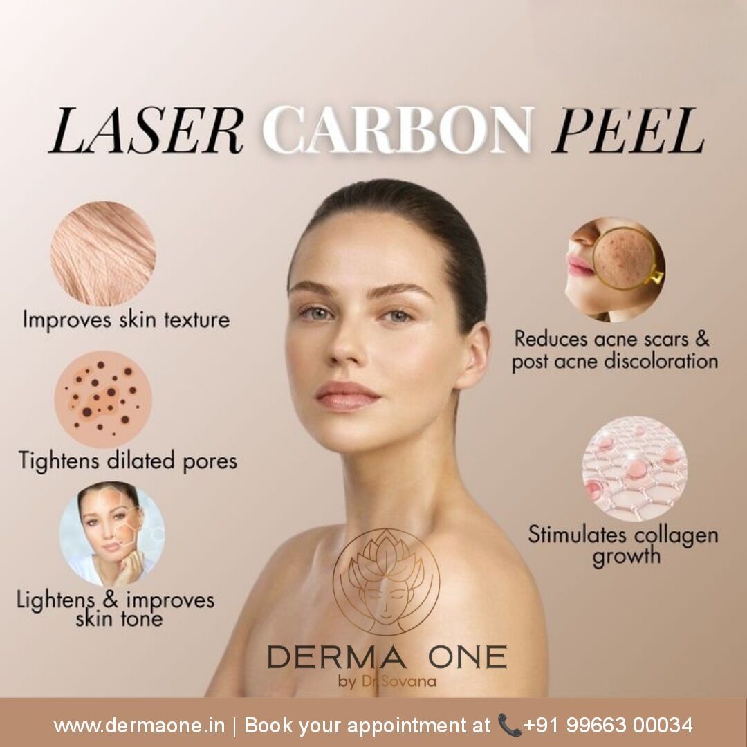 Visakhapatnam, Health, Carbon Laser Peel Benefits Derma One Clinic - Visakhpatnam
