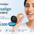 Affordable Invisalign Aligners In Pune | Starts At ₹49,500