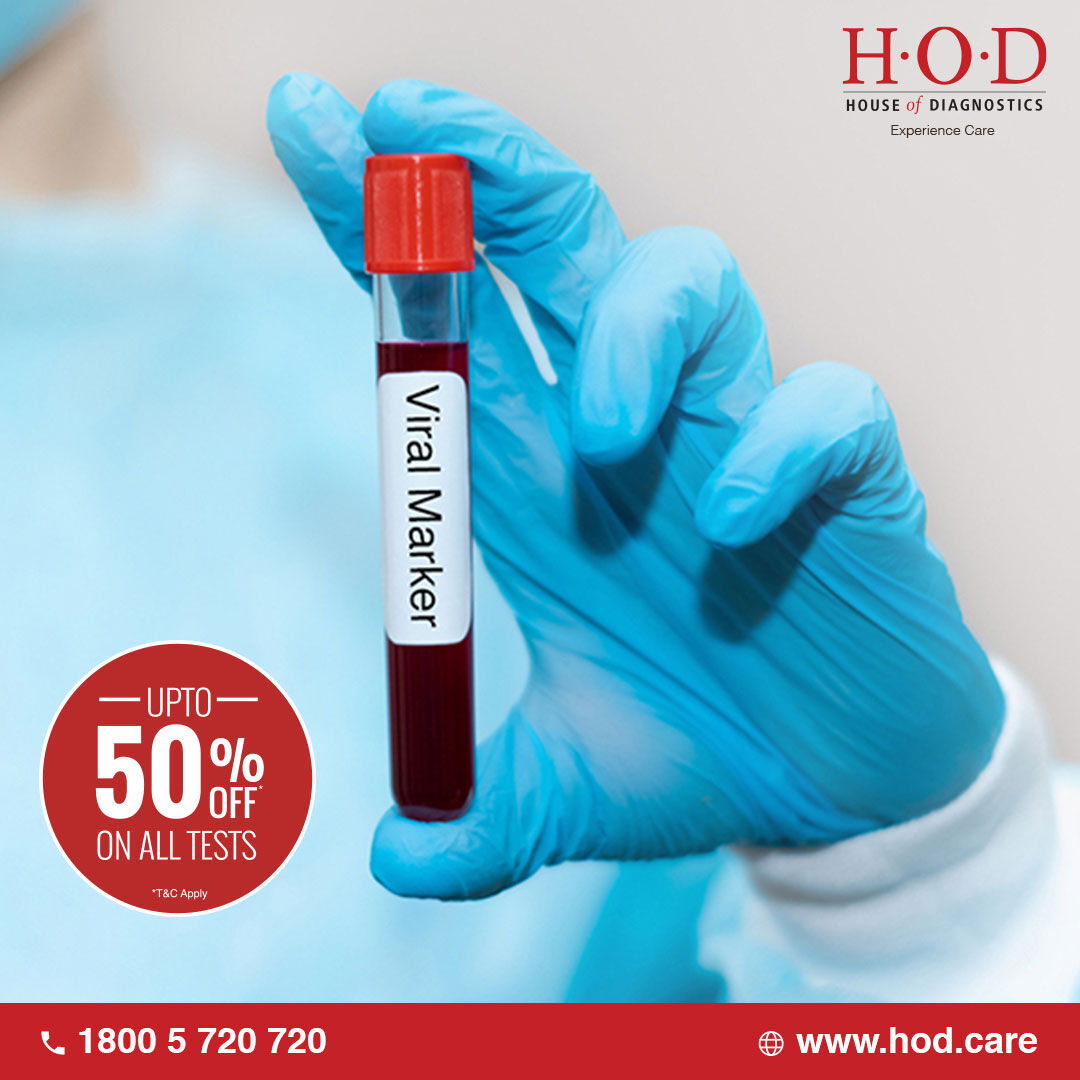 New Delhi, Health & Beauty Items, INR 999,  Viral Marker Blood Test: Purpose, Uses And Price Information