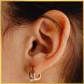 Ear Pinning Surgery In Los Angeles