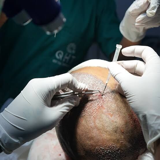 Dubai, Health & Beauty Items, AED 50,  Trusted Hair Transplant Clinic In The UAE For Natural Results