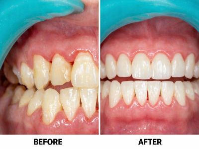 Kolkata, General, Affordable & Advanced Dental Care At AB Dentologic