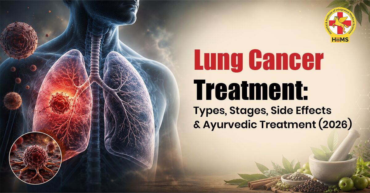 Mumbai, Health, Lung Cancer Treatment: Types, Stages & Ayurvedic Treatment (2026)