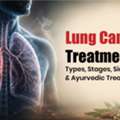 Lung Cancer Treatment: Types, Stages & Ayurvedic Treatment (2026)