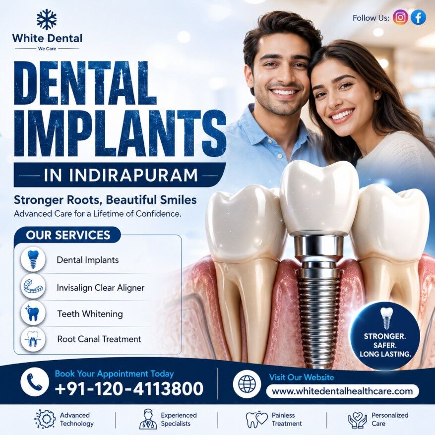 Ghaziabad, Dental, Dental Implants In Indirapuram | Best Implant Dentist Ghaziabad
