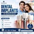 Dental Implants In Indirapuram | Best Implant Dentist Ghaziabad