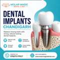Best Dental Implants Chandigarh | Molar Magic Dental