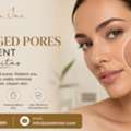 Best Enlarged Pores Treatment In Encinitas