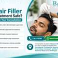 INR 3000,  Hair Filler Treatment In Banjara Hills, Hyderabad