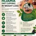 Hijama (Cuppin Therapy)