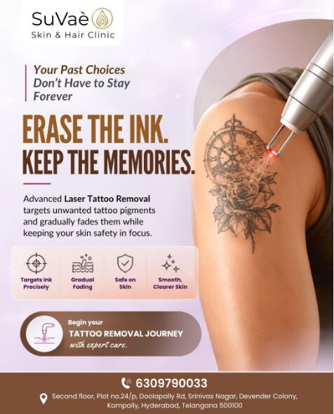Hyderabad, Health, Advanced Laser Treatments In Kompally Hyderabad | SuVae Skin & Hair Clinic