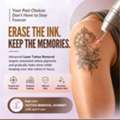 Advanced Laser Treatments In Kompally Hyderabad | SuVae Skin & Hair Clinic