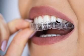 Brampton, Dental, Clear Aligners Brampton | Straighten Your Smile Comfortably