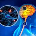 Multiple Sclerosis Treatment In Gurgaon | Expert Physiotherapy & Rehabilitation Care