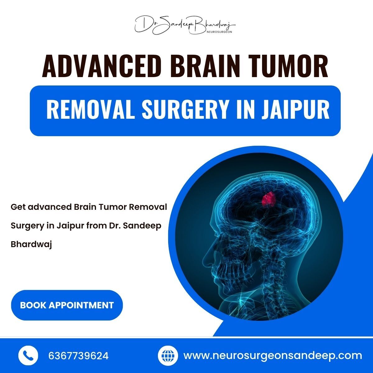 Jaipur, Health, Advanced Brain Tumor Removal Surgery In Jaipur
