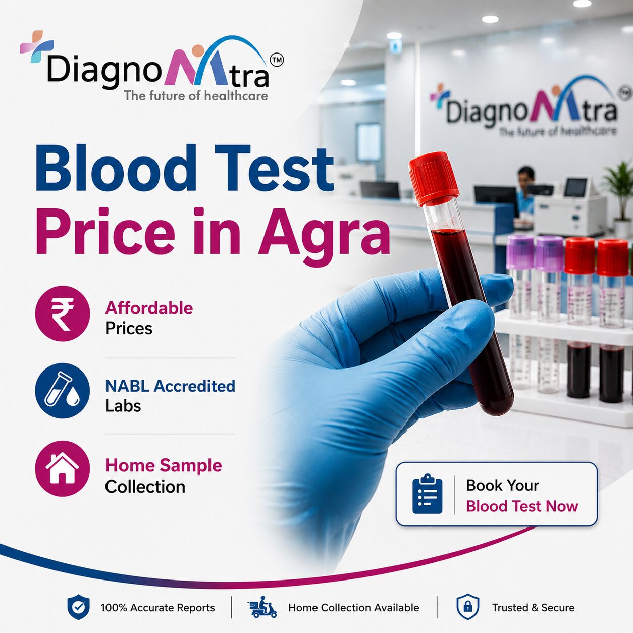 Noida, Health, Blood Test Price In Agra &ndash; Full Body Checkup Cost