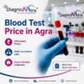 Blood Test Price In Agra &ndash; Full Body Checkup Cost