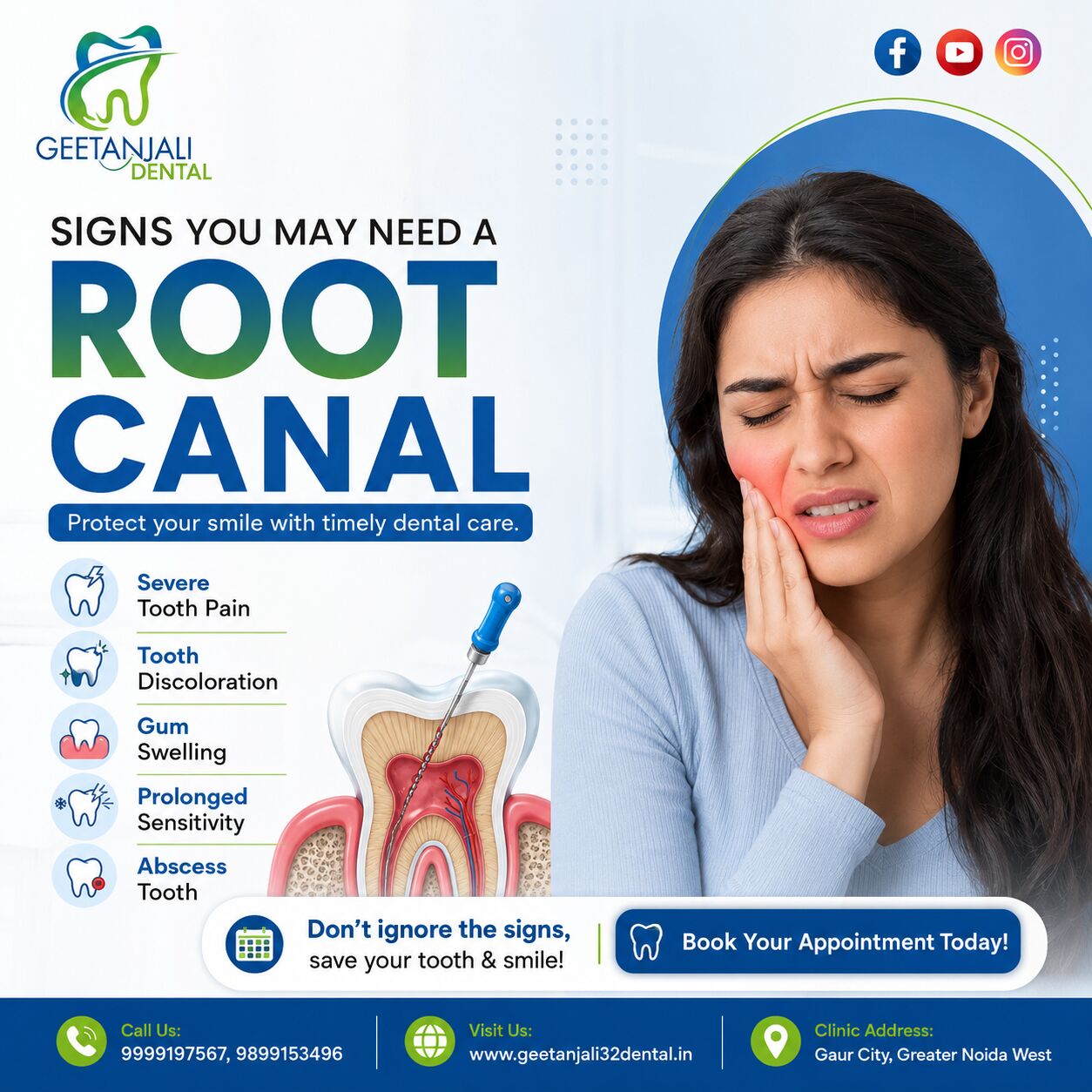 Greater Noida, Dental, Are You Looking For Root Canal Treatment In Gaur City?