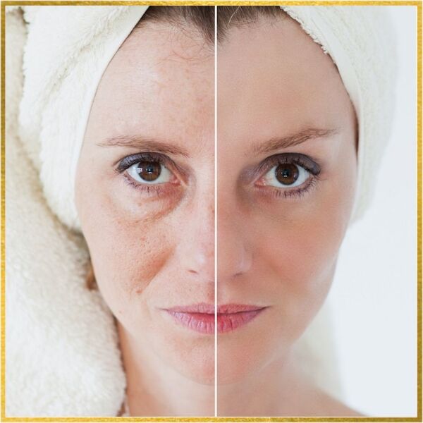 Los Angeles, Health, Facelift Surgery In Los Angeles