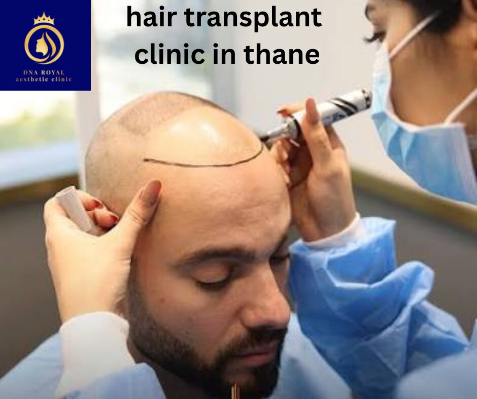 Thane, Fashion & Design, Best Hair Transplant Clinic In Thane | DNA Royal Hair Restoration.