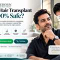 Need Hair Transplant Near Balewadi? Is It The Right Solution For Hair Loss?