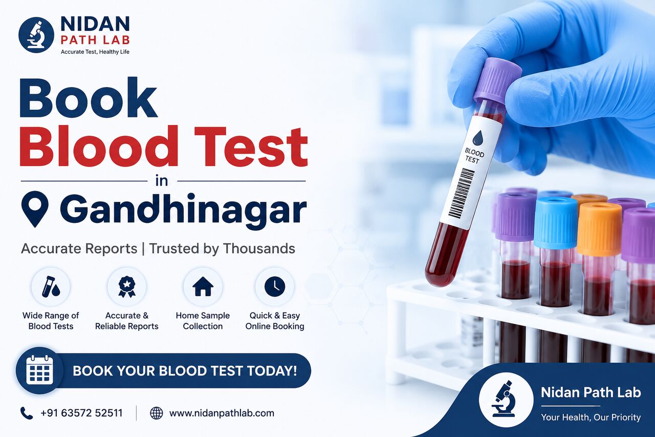 Ahmedabad, Health, Book Blood Test In Gandhinagar -  Nidan Path Lab