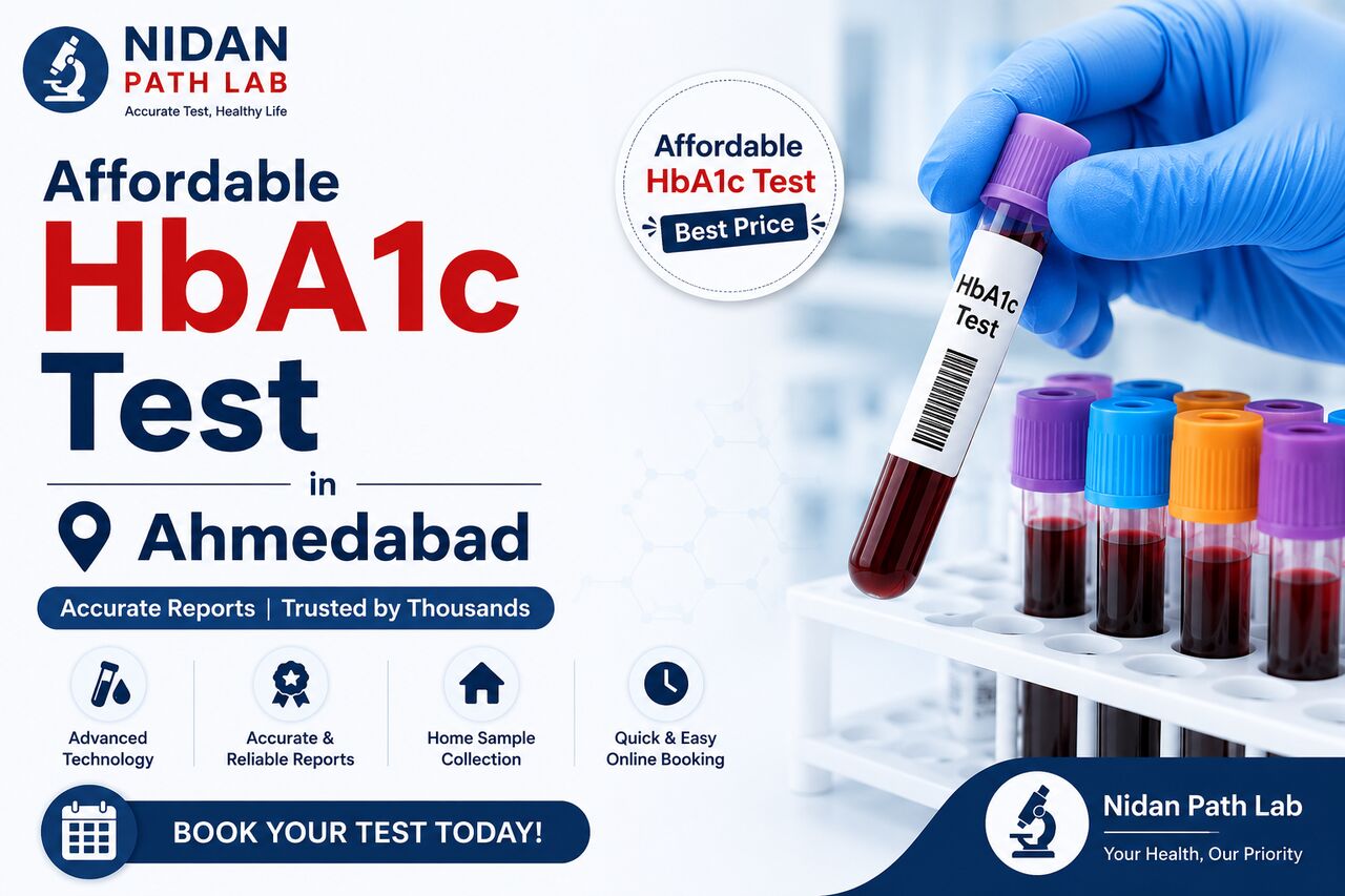 Ahmedabad, Health, Affordable HbA1c Test Price In Ahmedabad -  Nidan Path Lab