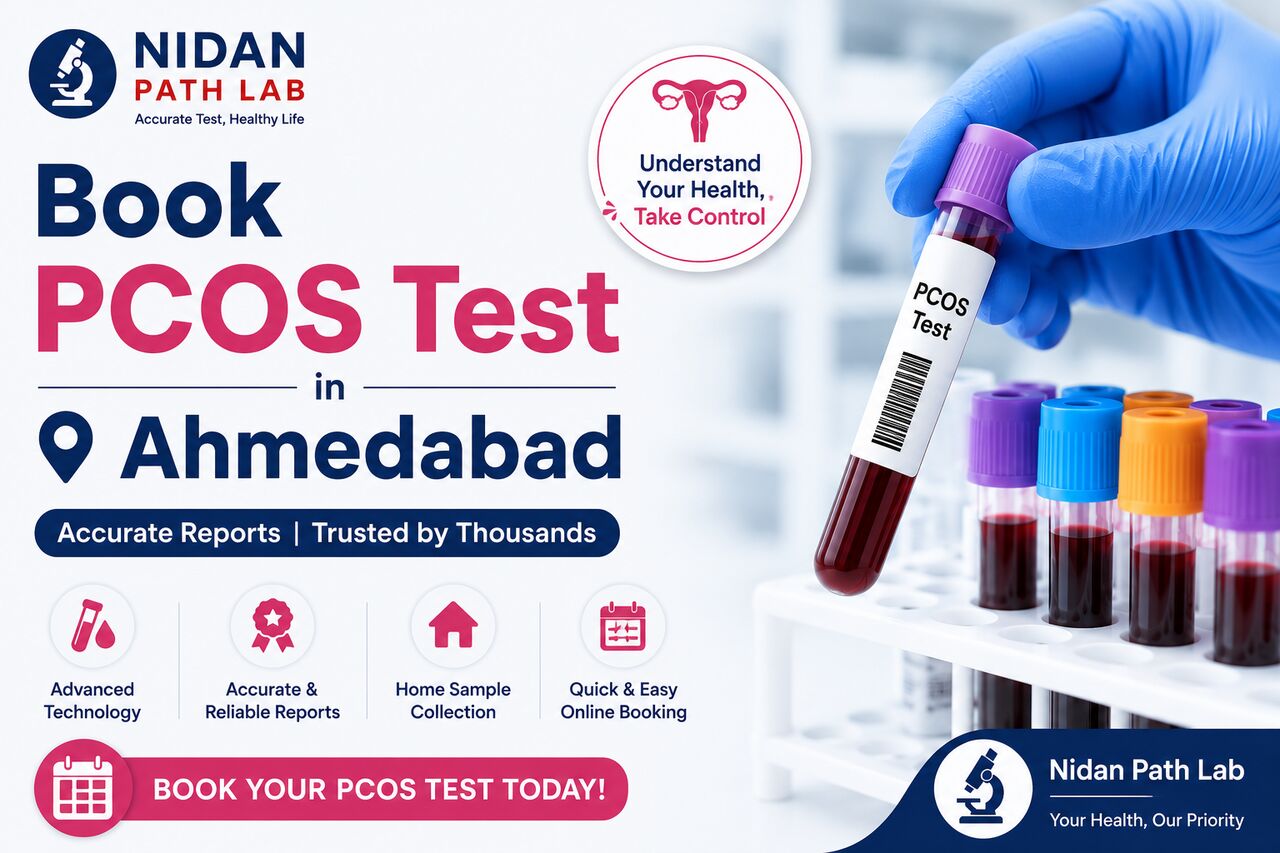 Ahmedabad, Health, Book PCOS Test In Ahmedabad -  Nidan Path Lab