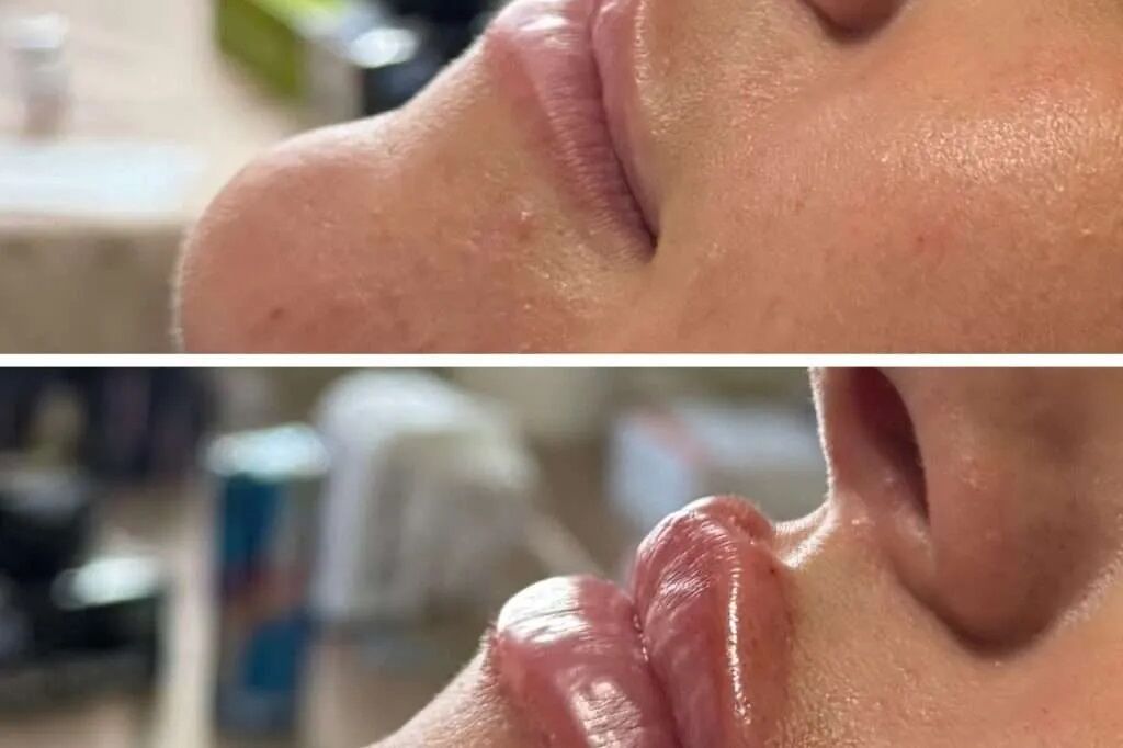 New York, Beautician, Glow Lab Medspa