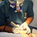 Best Hair Transplant Doctor In Delhi | Advanced Hair Restoration Clinic | Alloroots