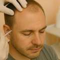 Transform Your Hair And Life With Delhi's Most Trusted Hair Transplant Clinic