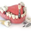 DNG Dental Clinic &ndash; Best Dental Clinic In Jaipur For Complete Dental Care