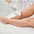 How Microneedling Treatment Laval Improves Skin Texture And Glow Fast?